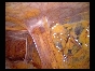 ADHESIONS BOWELS OMENTAL2 ADHESIONS BOWELS OMENTAL2